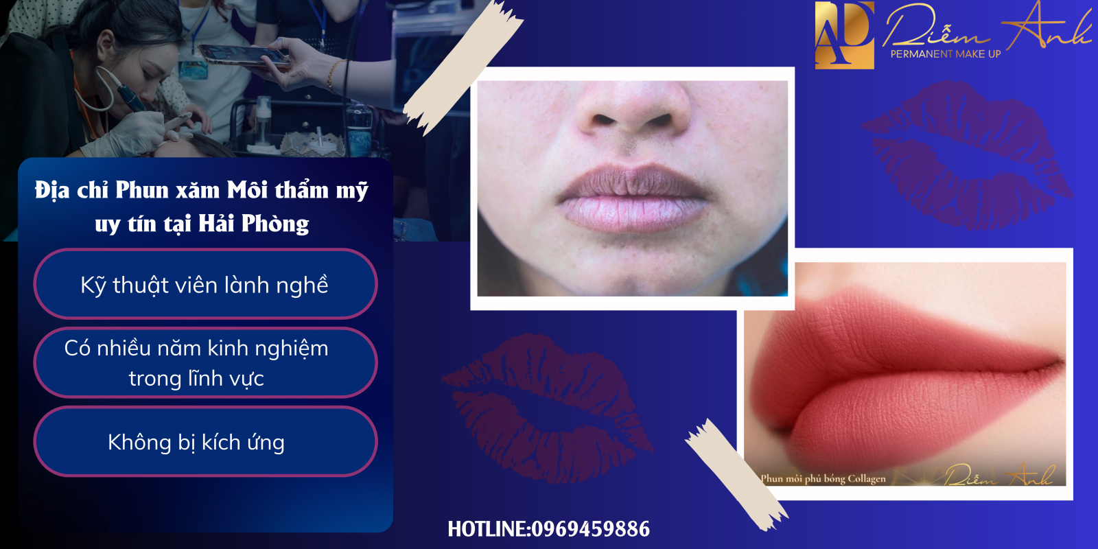 xam moi uy tin hai phong