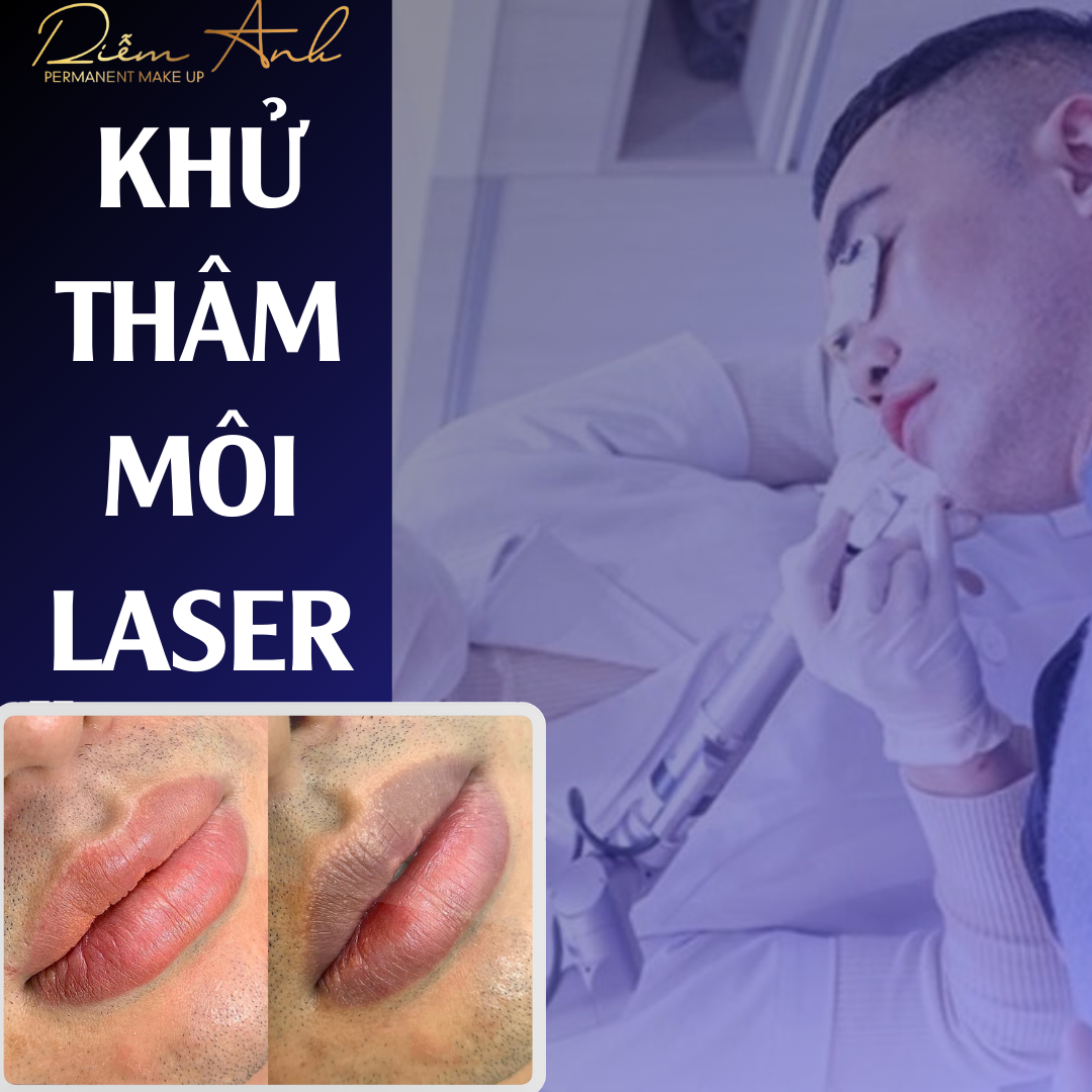 khu-tham-moi
