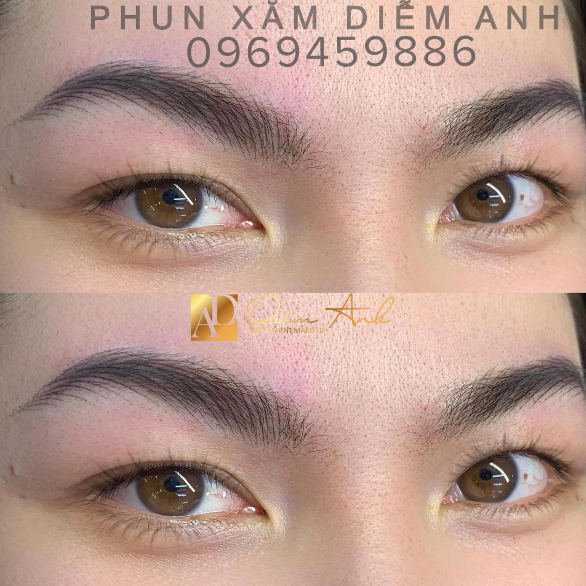 phun-xam-diem-anh