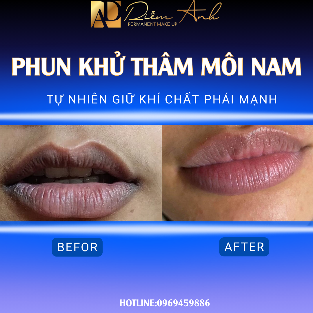 khu-tham-moi