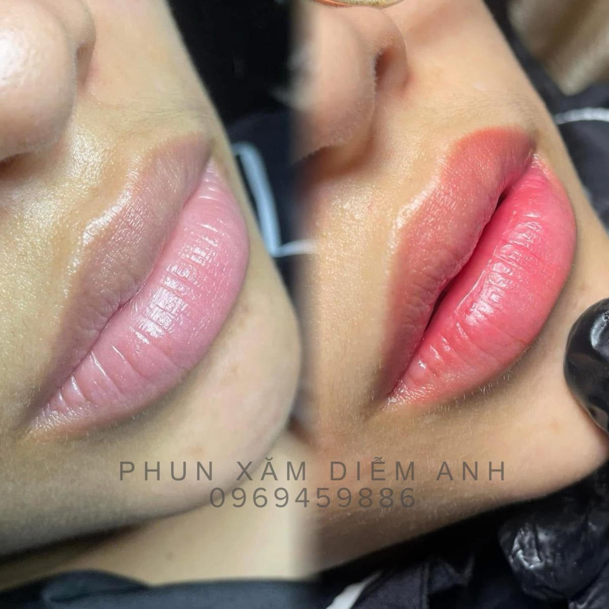 khu-tham-moi