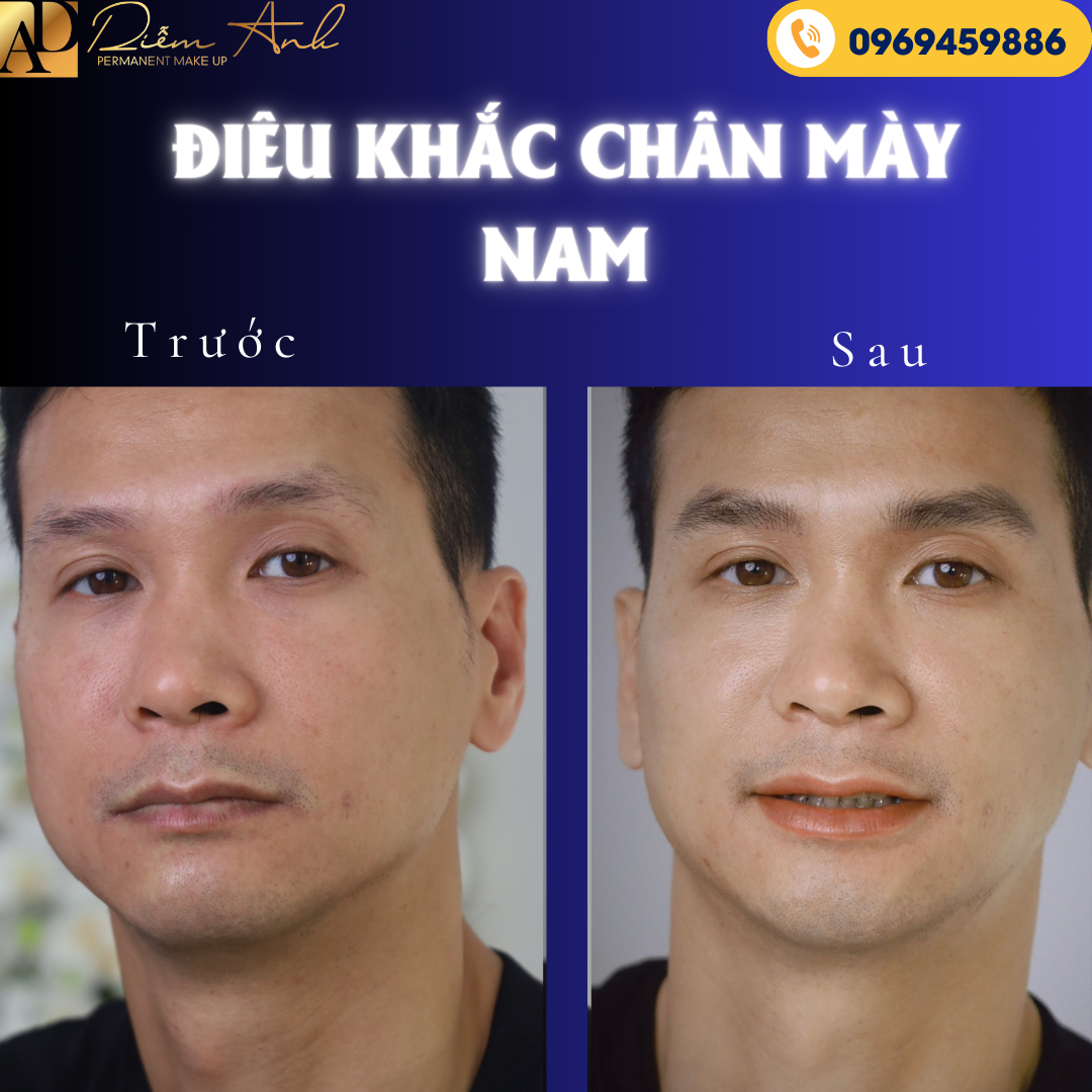dieu khac chan may nam