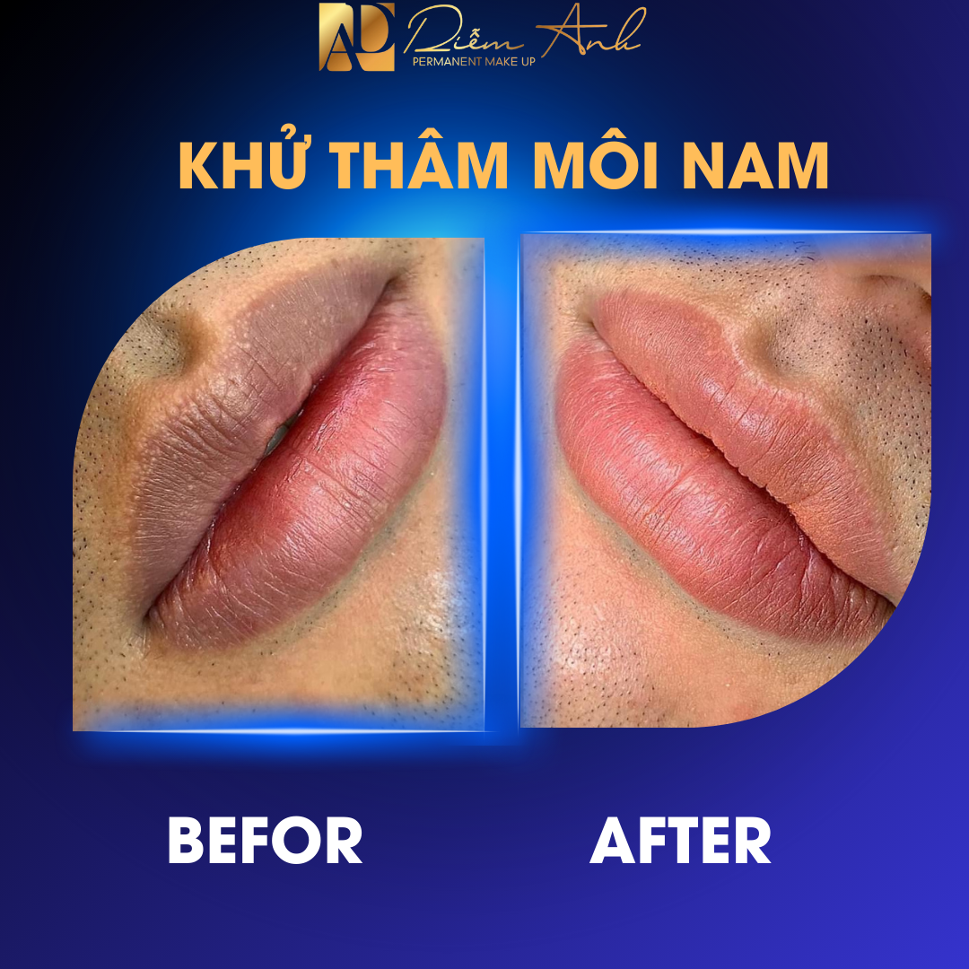 khu tham moi