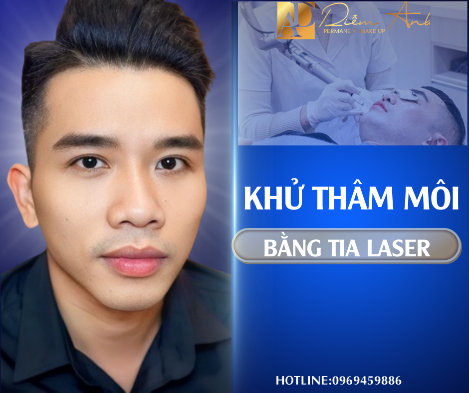 khu tham moi nam lazer
