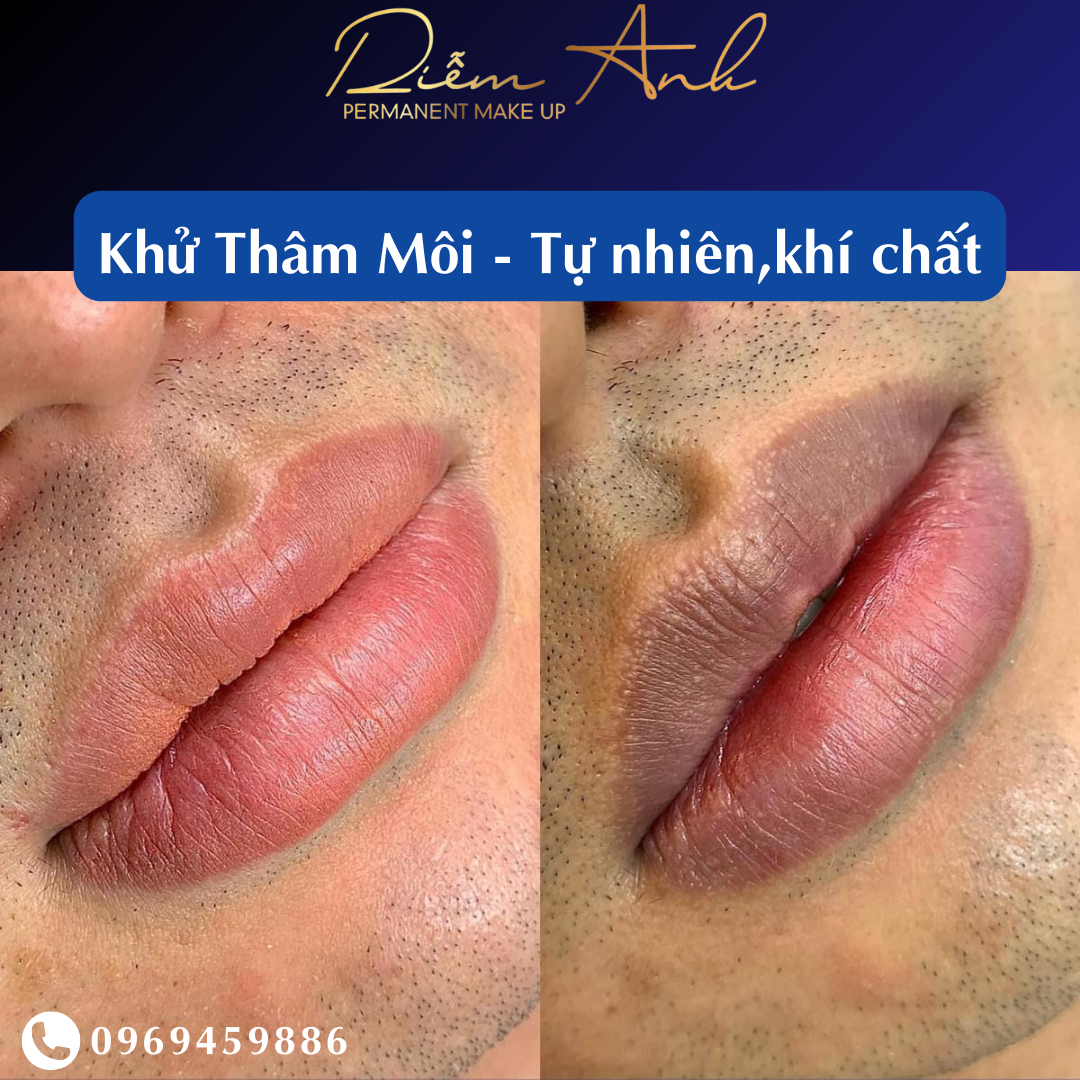 khu tham moi