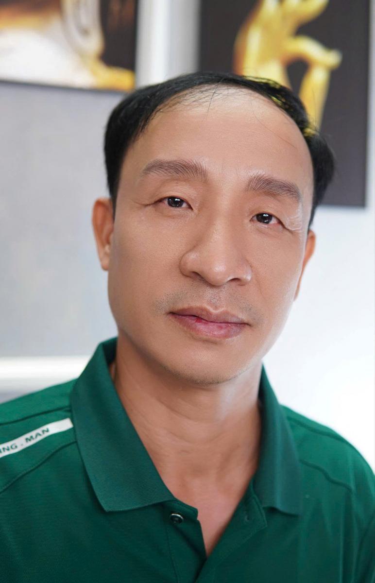 dieu khac chan may nam