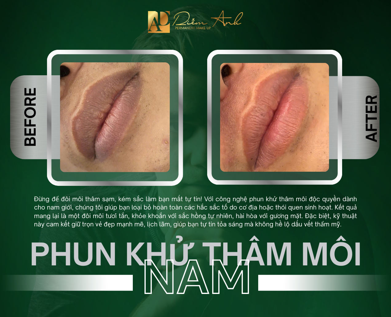 khu-tham-moi-nam