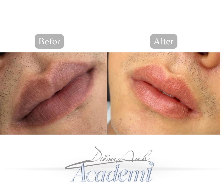 khu-tham-moi-tai-phun-xam-diem-anh