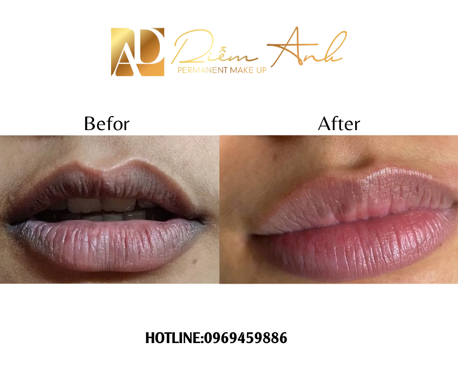 khu-tham-moi-tai-phun-xam-diem-anh