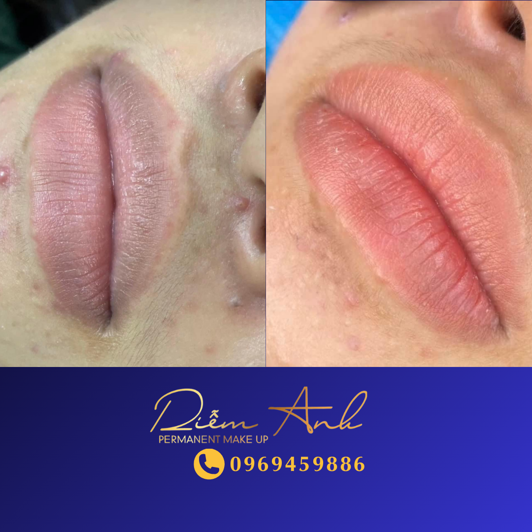 khu-tham-moi-tai-phun-xam-diem-anh