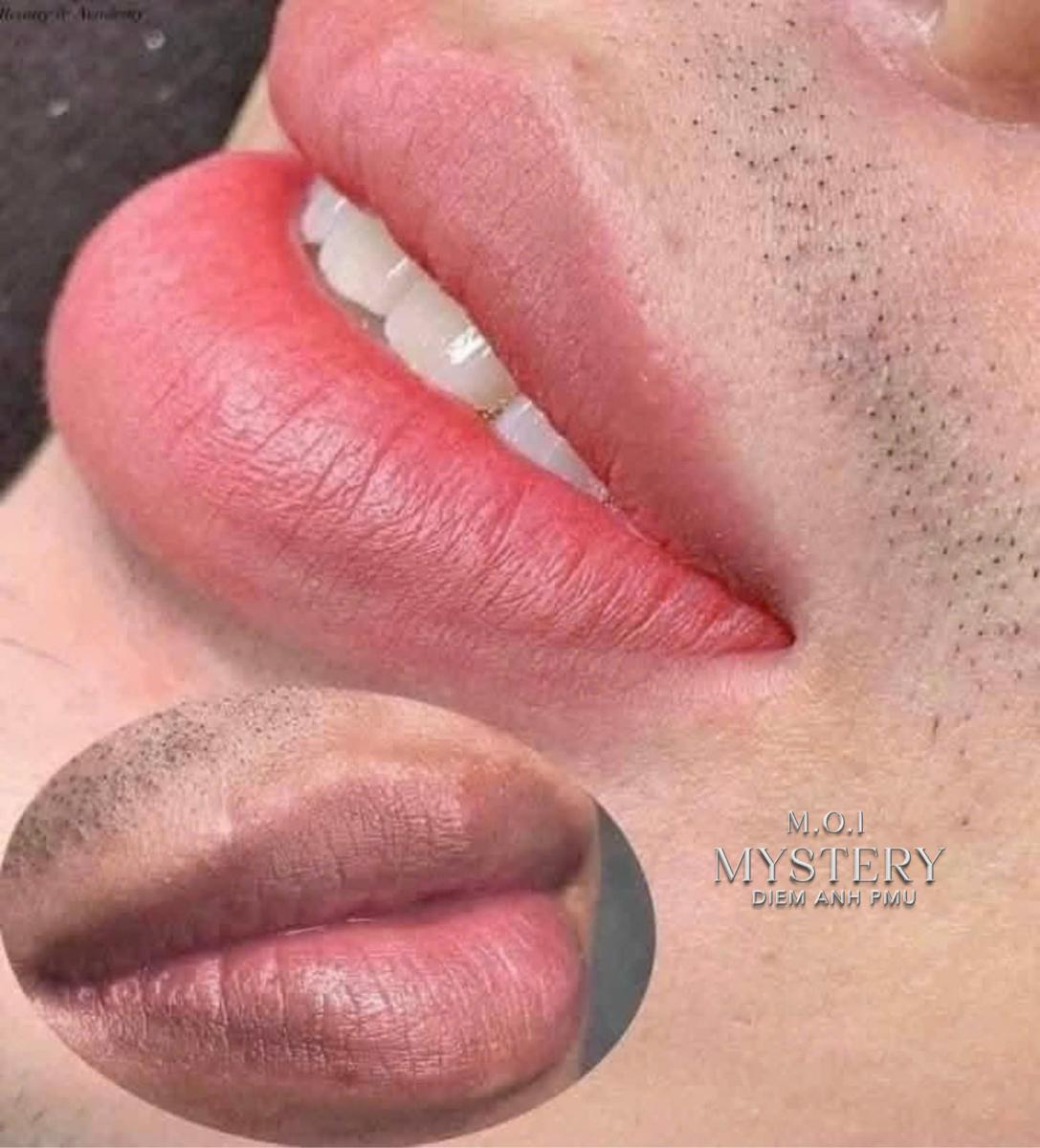 khu tham moi nam hai phong