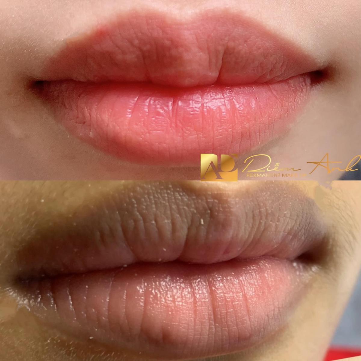 khu tham moi nam uy tin