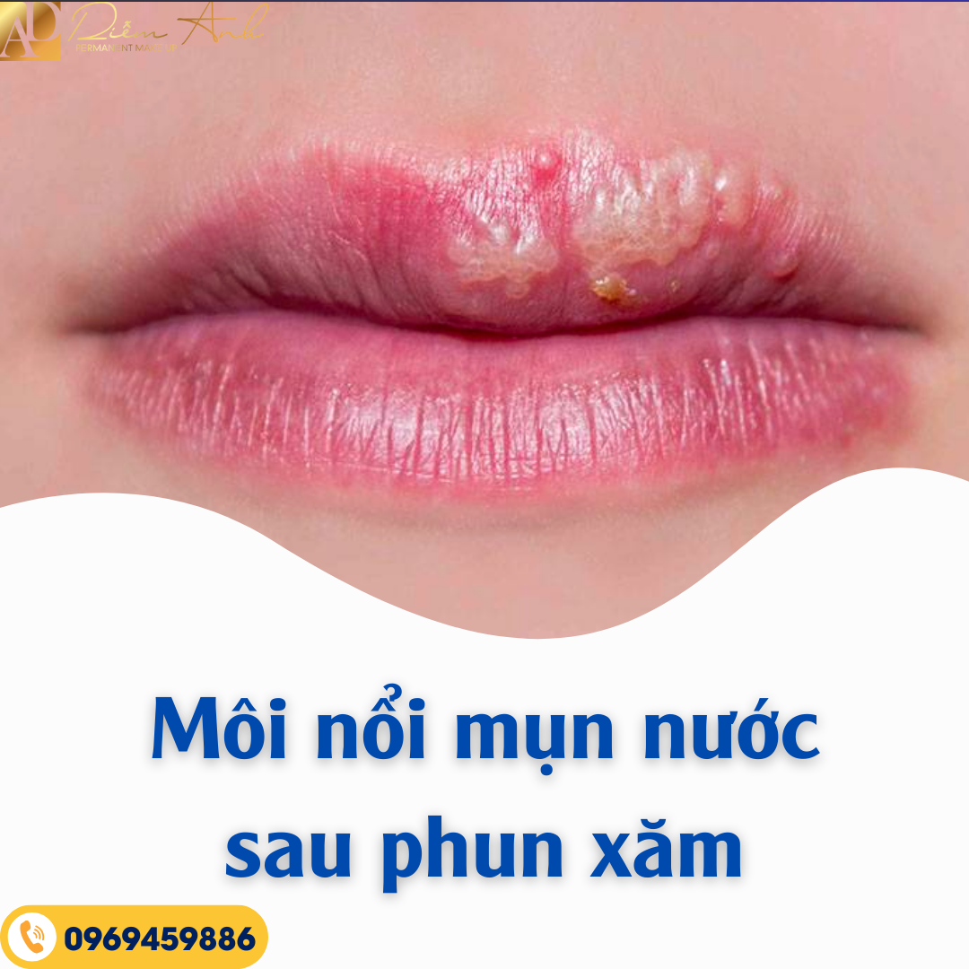 noi mun nuoc sau phun xam
