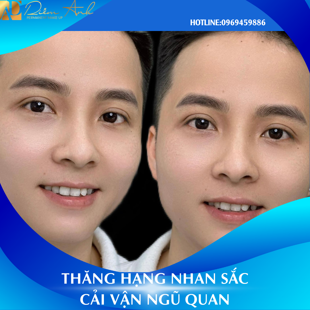 gay-soi-long-may-nam